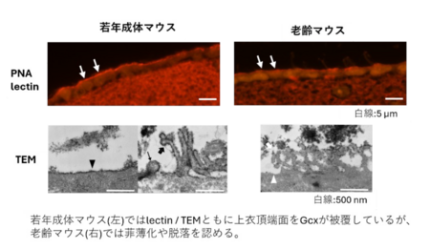 脳室を守る“糖のバリア”が老化や出血で壊れる仕組みを解明 | プレス